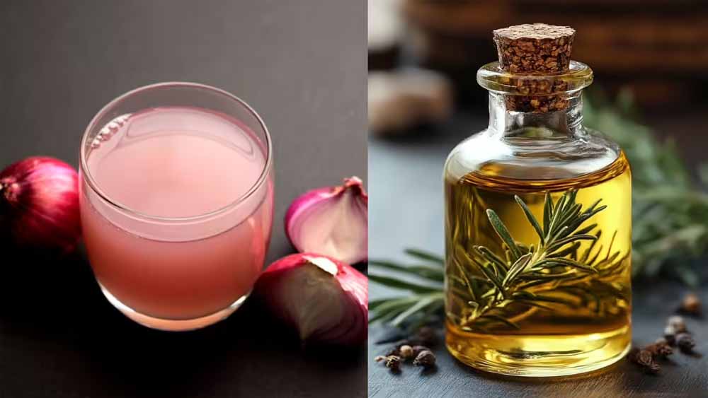 प्याज बनाम रोजमेरी ऑयल: बालों की ग्रोथ के लिए कौन है ज्यादा कारगर?