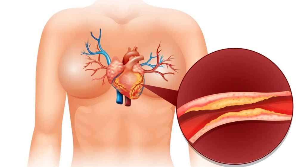 कोलेस्ट्रॉल क्या है और शरीर में इसकी क्या भूमिका होती है?