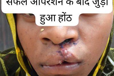सफल सर्जरी से भीमे हेमला के चेहरे पर लौटी मुस्कान