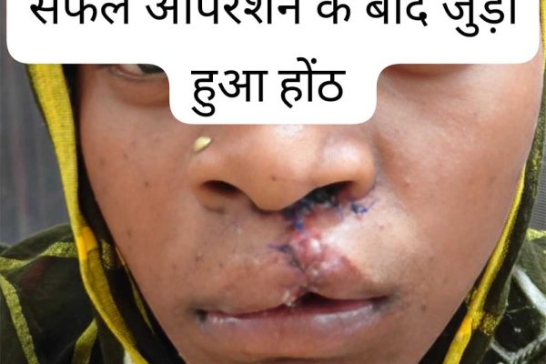 सफल सर्जरी से भीमे हेमला के चेहरे पर लौटी मुस्कान