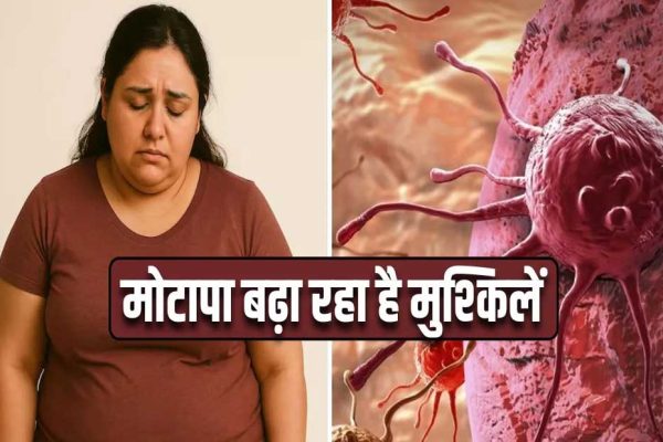 मोटापा-तनाव बढ़ा रहे कैंसर का खतरा! पुरुषों में ओरल तो महिलाओं में ब्रेस्ट कैंसर के मामले बढ़े